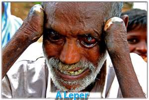 leper